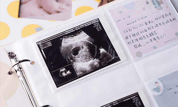 詠安健康膳食月子餐